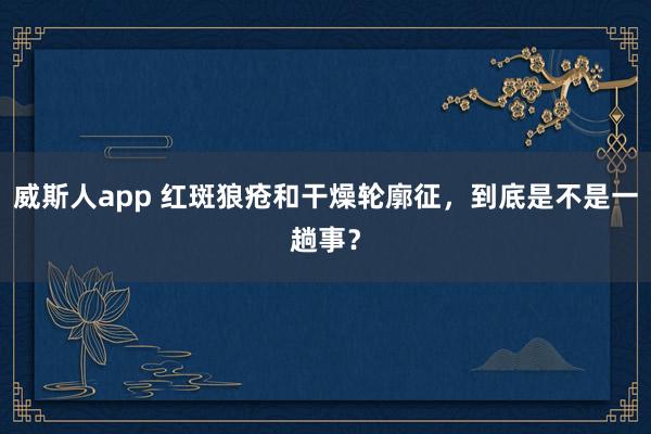 威斯人app 红斑狼疮和干燥轮廓征，到底是不是一趟事？